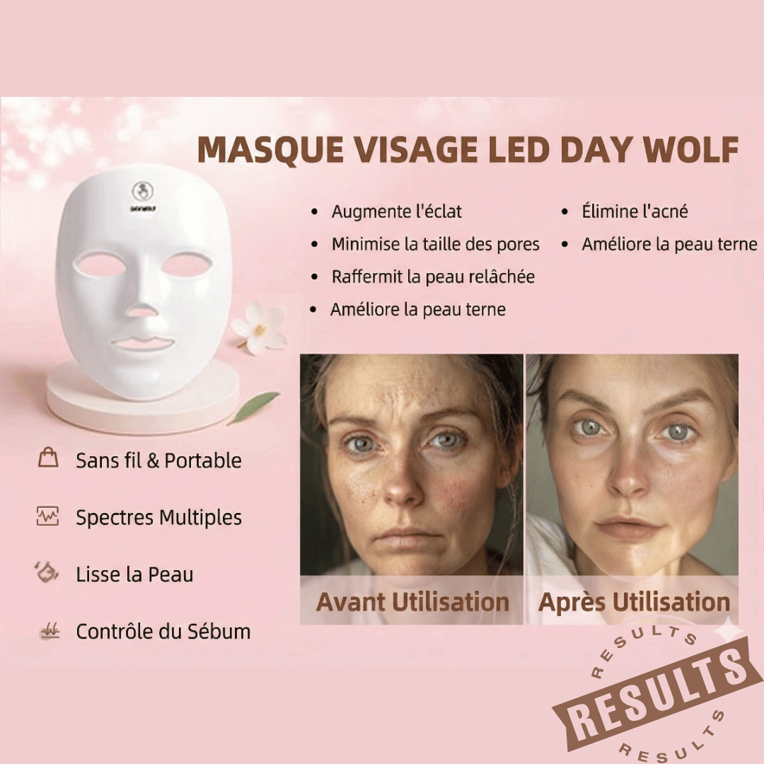 LuxeDerma™ Soin LED Visage showing effective LED facial treatment results for skin improvement.